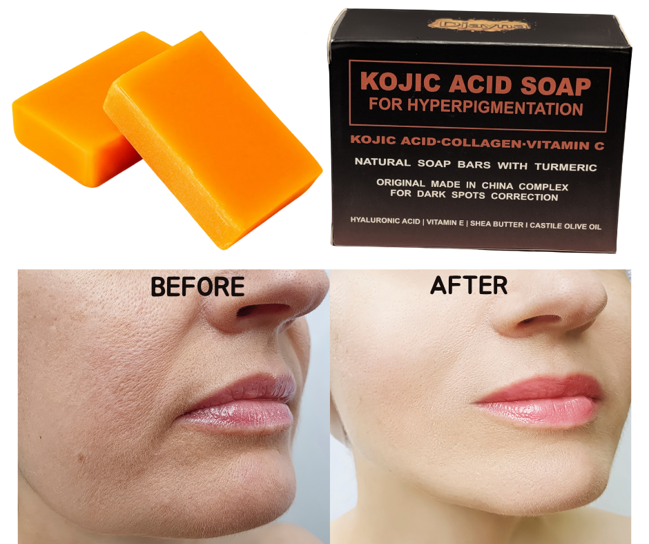 2 Kojic Acid Bar Soap